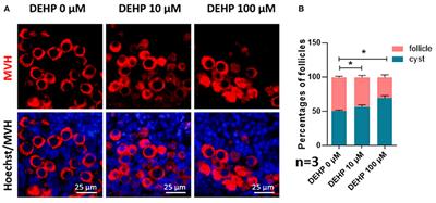 Di (2-ethylhexyl) Phthalate Exposure Impairs the microRNAs Expression Profile During Primordial Follicle Assembly